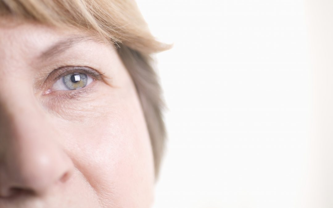 Dermatocálase e a blefaroplastia como correção do problema