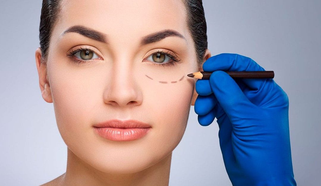 Pensando em fazer cirurgia de pálpebras? Conheça os resultados e recuperação