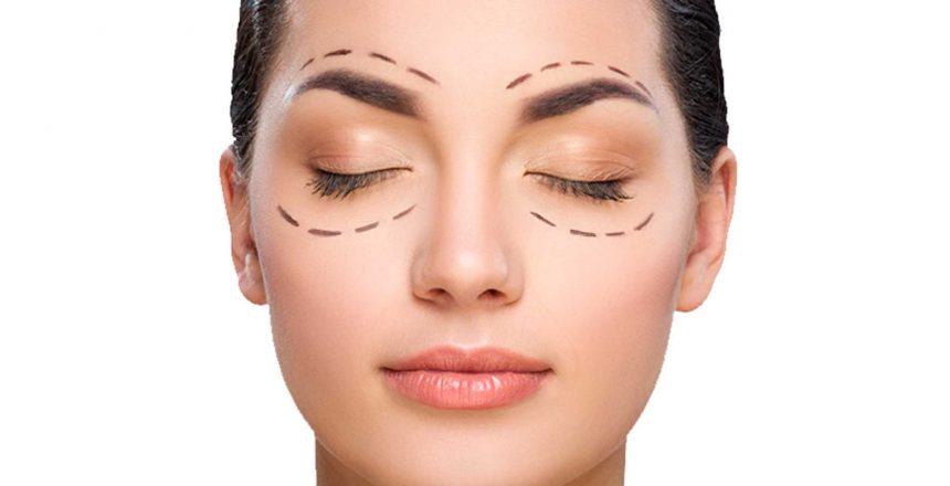 Cirurgia de pálpebras: para quem é indicado?